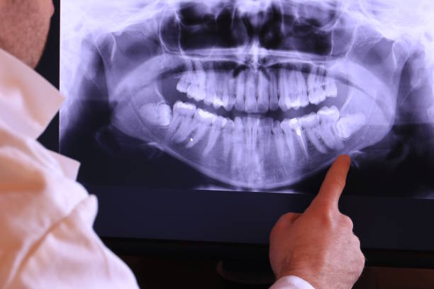 Best Emergency Broken Tooth Repair in Edina, MO