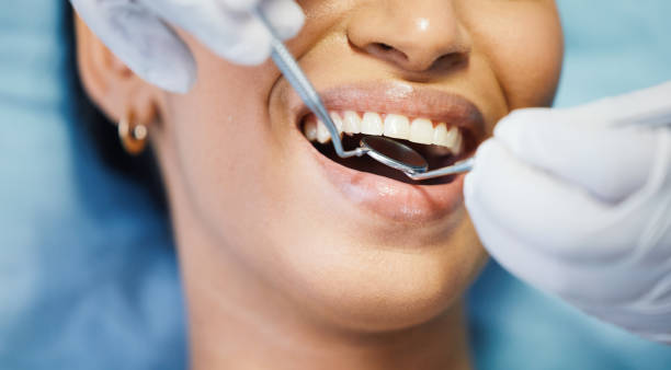 Best Emergency Tooth Extraction in Edina, MO